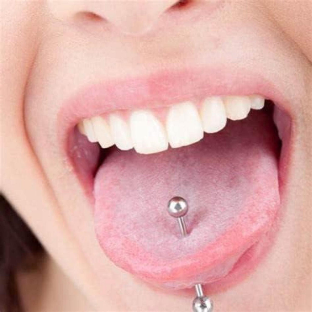 Zungenpiercing Set 5 Stück 16mm Barbell 1,6mm Chirurgenstahl Kunststoff