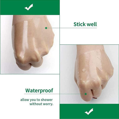 Wasserdichte Gipsrolle 10cm x 10m – Transparenter Verband