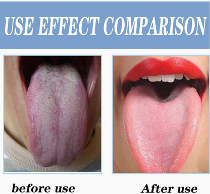 Zungenreiniger Edelstahl Tongue Scraper für frischen Atem
