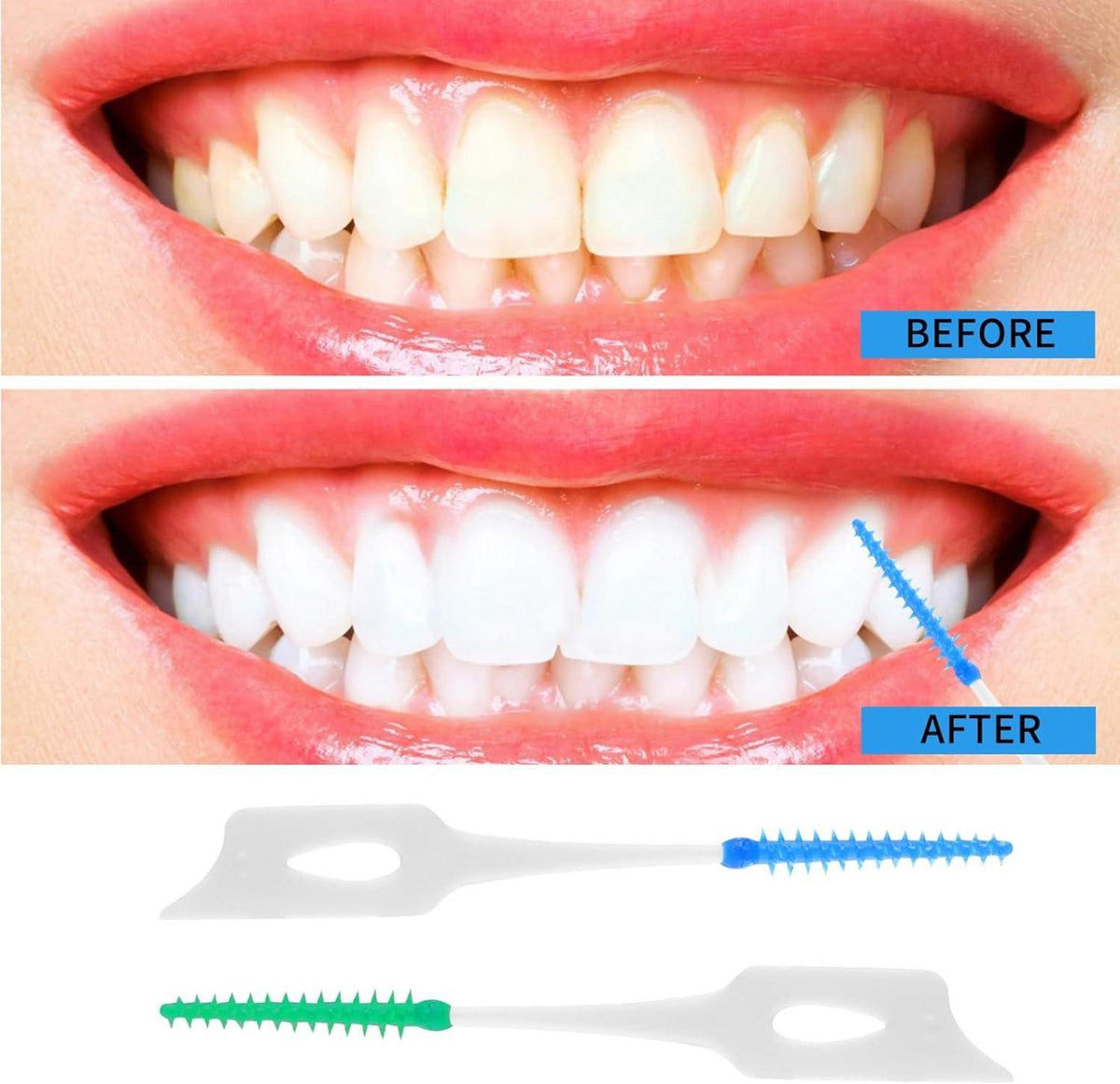 200 Stück Interdentalbürsten Silikon mit Box und Zahnseide Stick Blau Grün