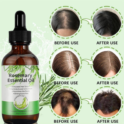Rosmarinöl 100% 180ml für Haarwachstum Set gegen Haarausfall