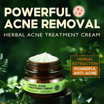 Herbal Anti-Akne Serum und Creme Set Natürliche Pflege