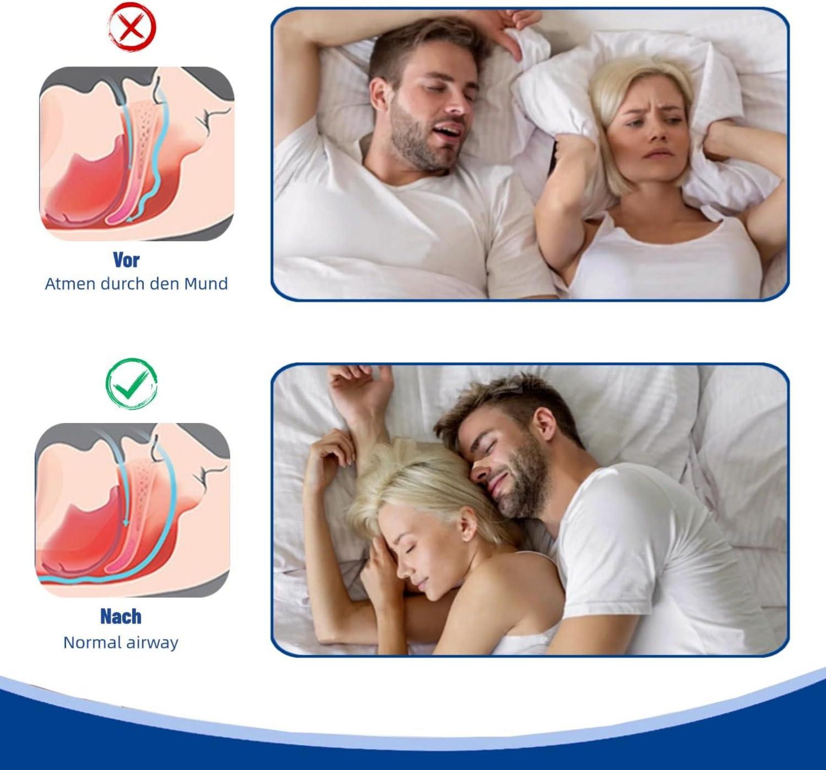 Nasenpflaster Schnarchstopper Nasal Strips Anti Schnarch