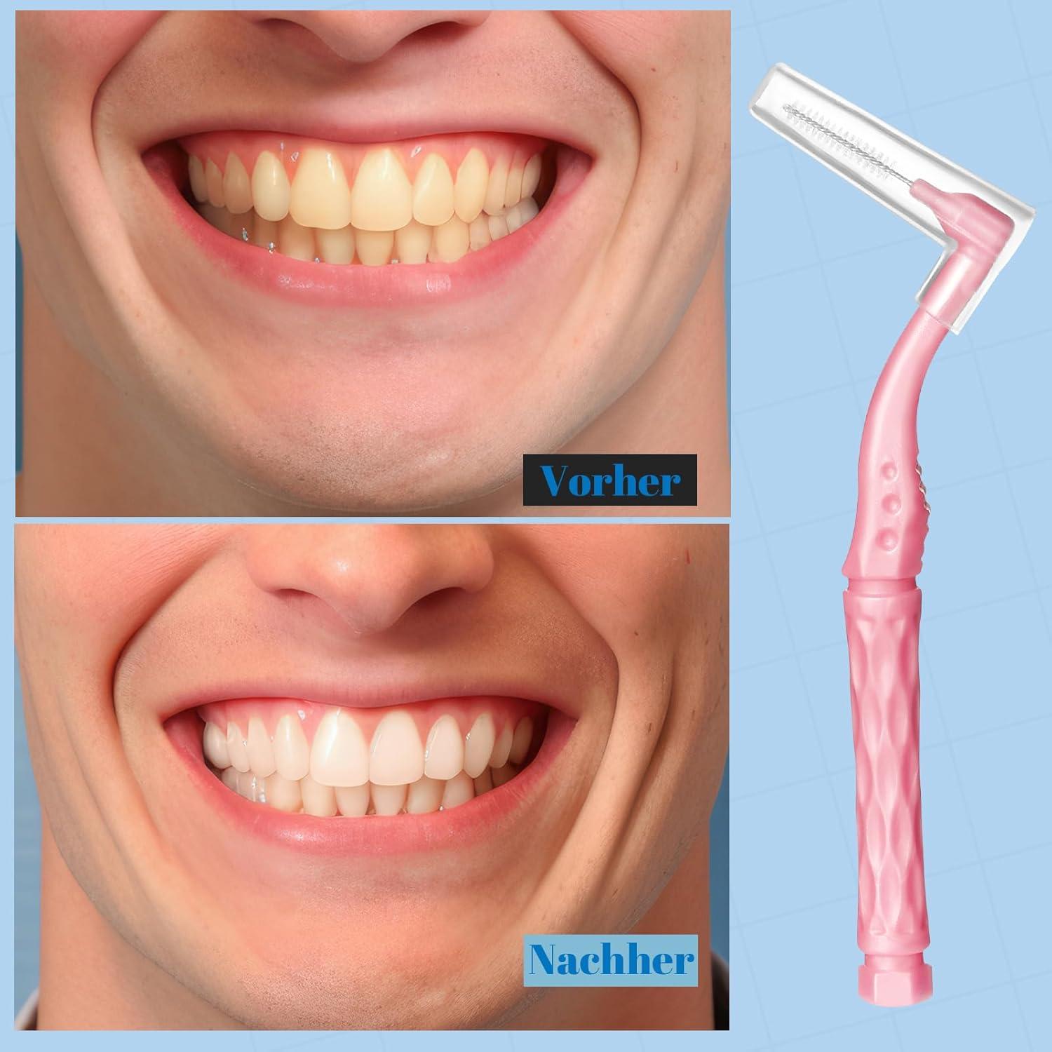 50 Stück Interdentalbürsten L-Form Zahnzwischenraum Bürsten 5 Größen Rutschgriff