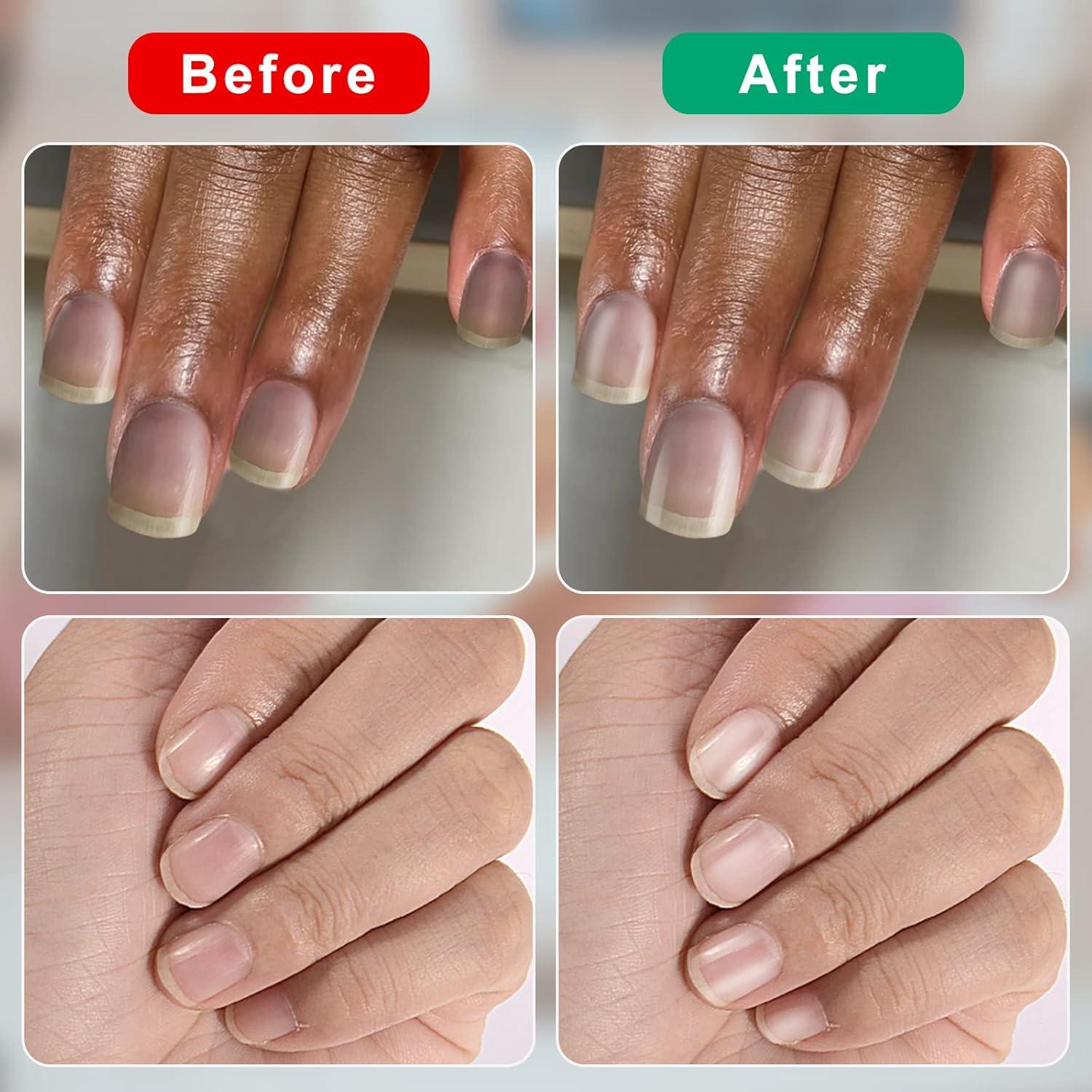 Feine Mini Buffer für Nägel 1000/4000 Körnung Hochglanz-Nagelbuffer 50 Stk