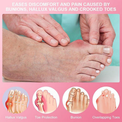 Hallux Valgus Korrektur Schiene mit Zehenspreizer, Rosa