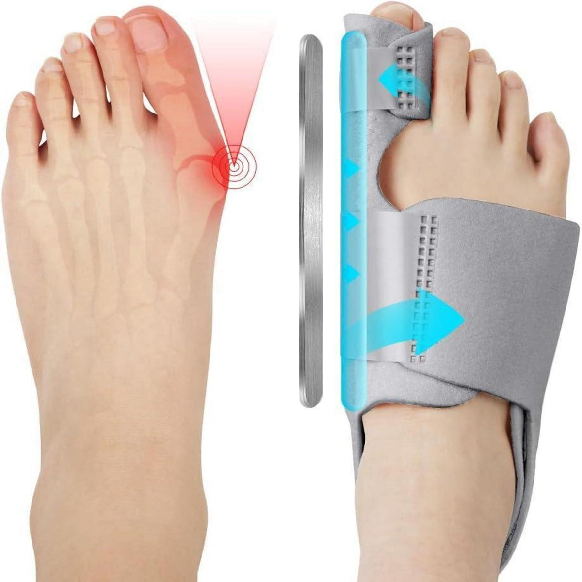 Hallux Valgus Korrektur Schiene mit Zehenspreizer - Grau