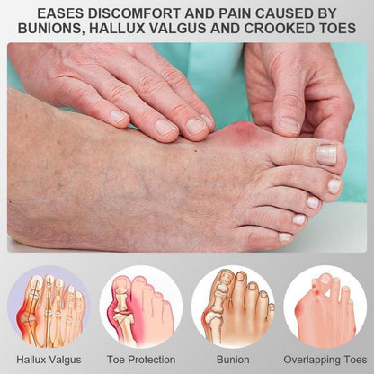 Hallux Valgus Korrektur Schiene mit Zehenspreizer - Grau
