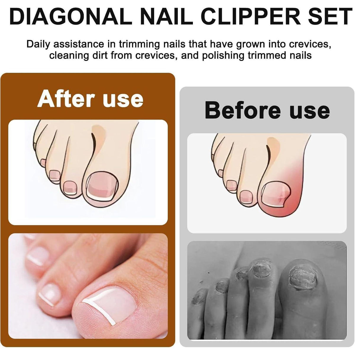 3-teiliges Nagelknipser Set für dicke & eingewachsene Nägel