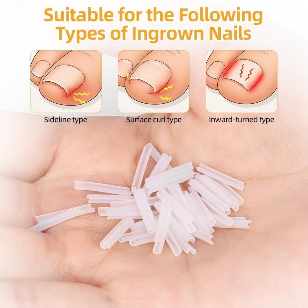 Eingewachsene Zehennägel Set – 110tlg. Pediküre Kit für Zuhause