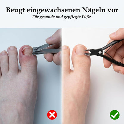 Fußnagelschere mit Spritzschutz & rutschfestem Griff